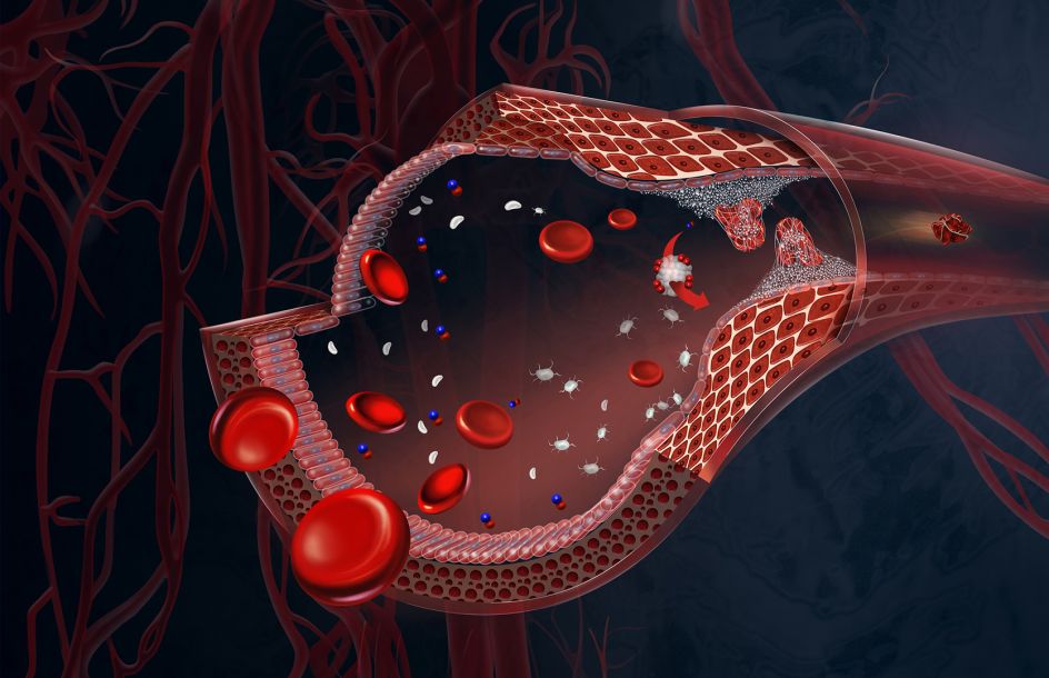Artery Cutaway © Brian Harrold