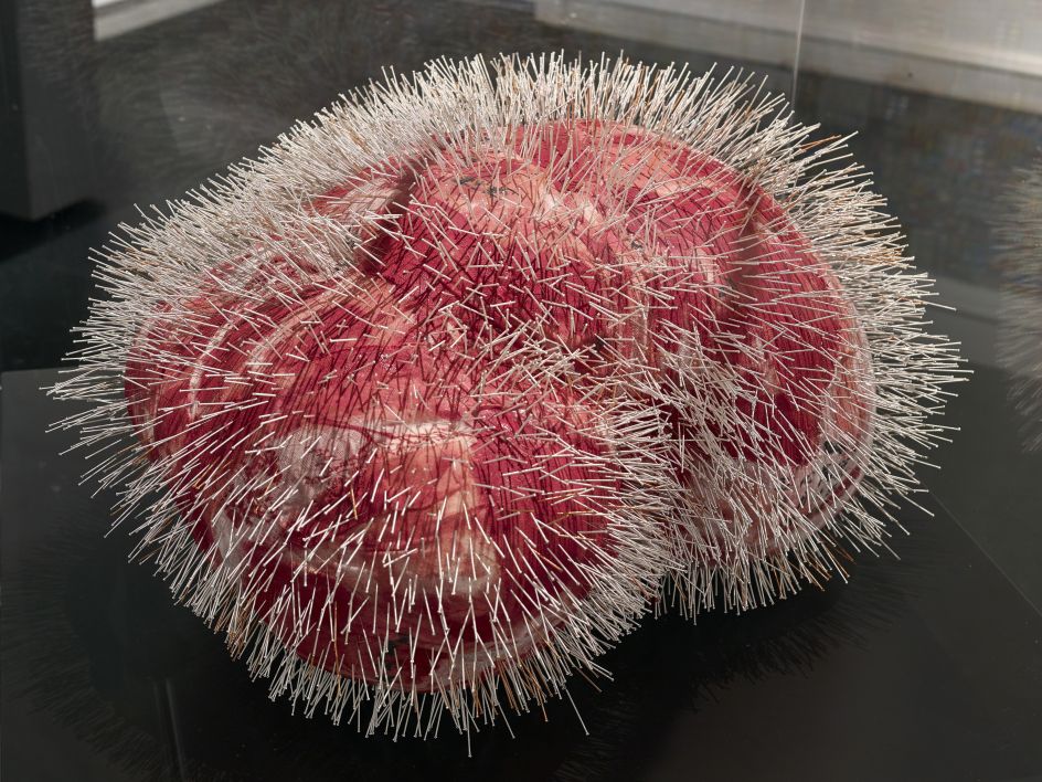 All the Volcanoes are Nothing but Acne by Zhang Yanzi at Surgeons' Hall Museums. Credit: John McKenzie and Galerie Ora-Ora