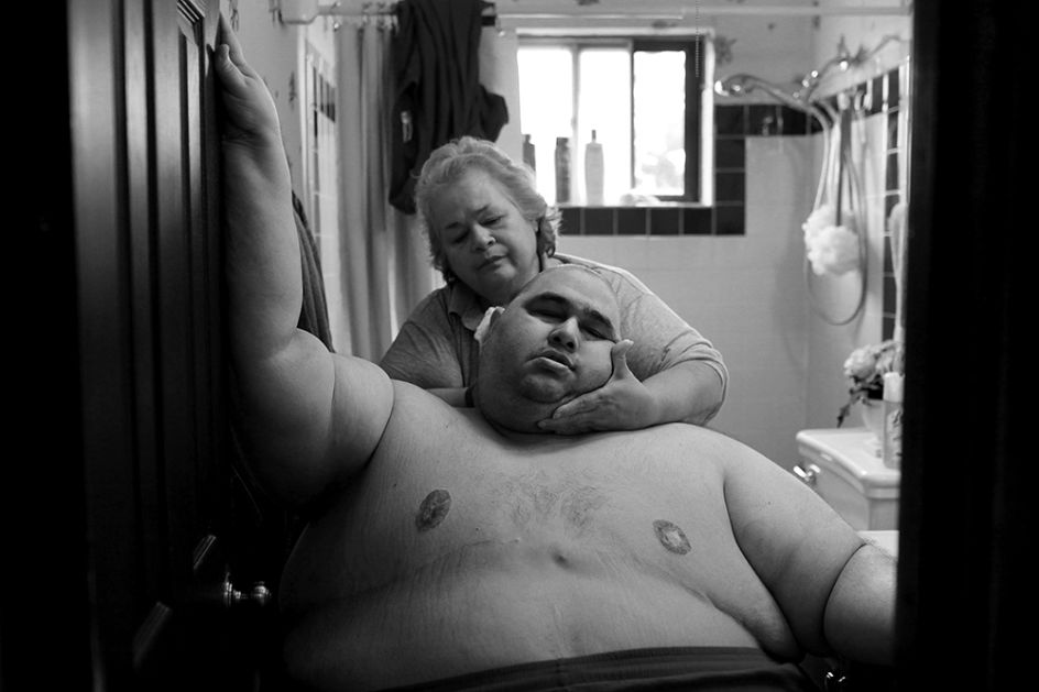A Life Apart: The Toll of Obesity by Lisa Krantz, United States, Shortlisted, Contemporary Issues, Professional, 2015 Sony World Photography Awards