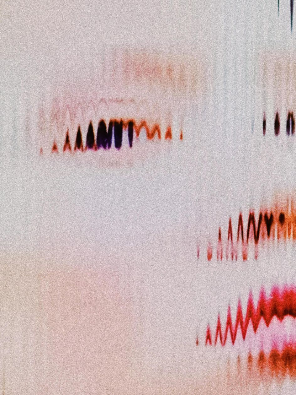 Juergen Teller and Wolfgang Tillmans respond to 'digital addiction