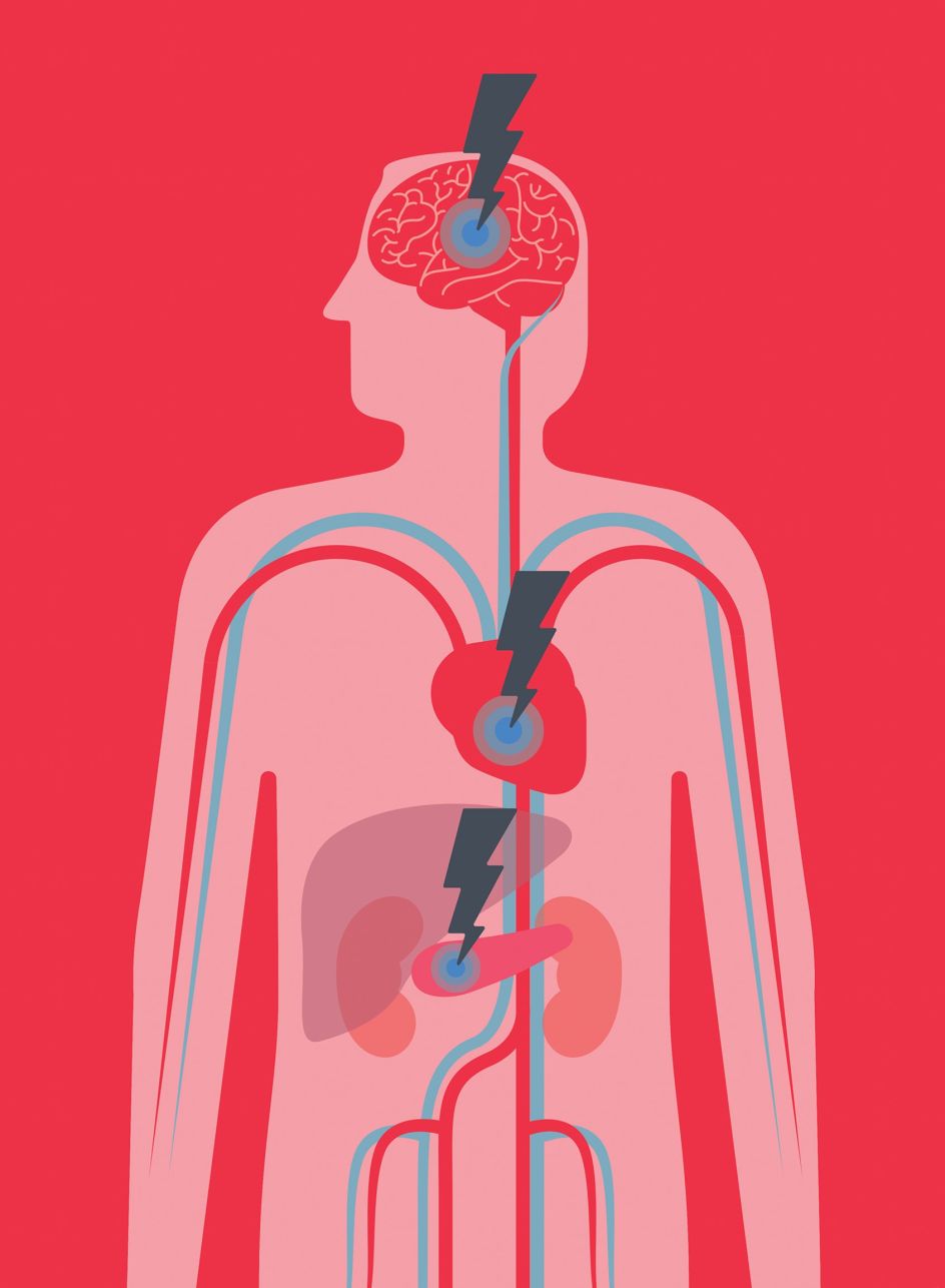 An illustration for the British Heart Foundation, showing some of the effects of Diabetes on the body © Andrew Baker