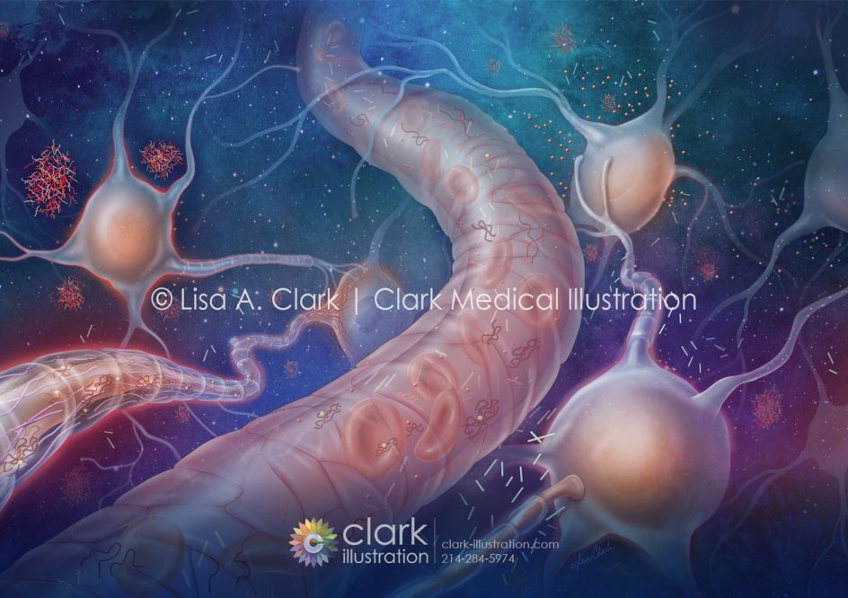 Alzheimer's Disease Biomarkers © Lisa A. Clark