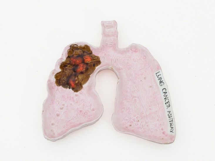 Becky Howland – Lung Cancer Ashtray (#57), 1984. Fisher Parrish Gallery