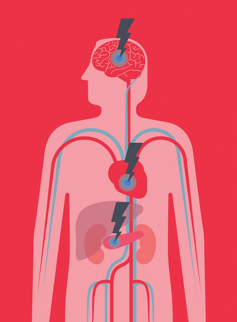 An illustration for the British Heart Foundation, showing some of the effects of Diabetes on the body © Andrew Baker